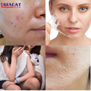 Tẩy Tế Bào Chết Định Kỳ
