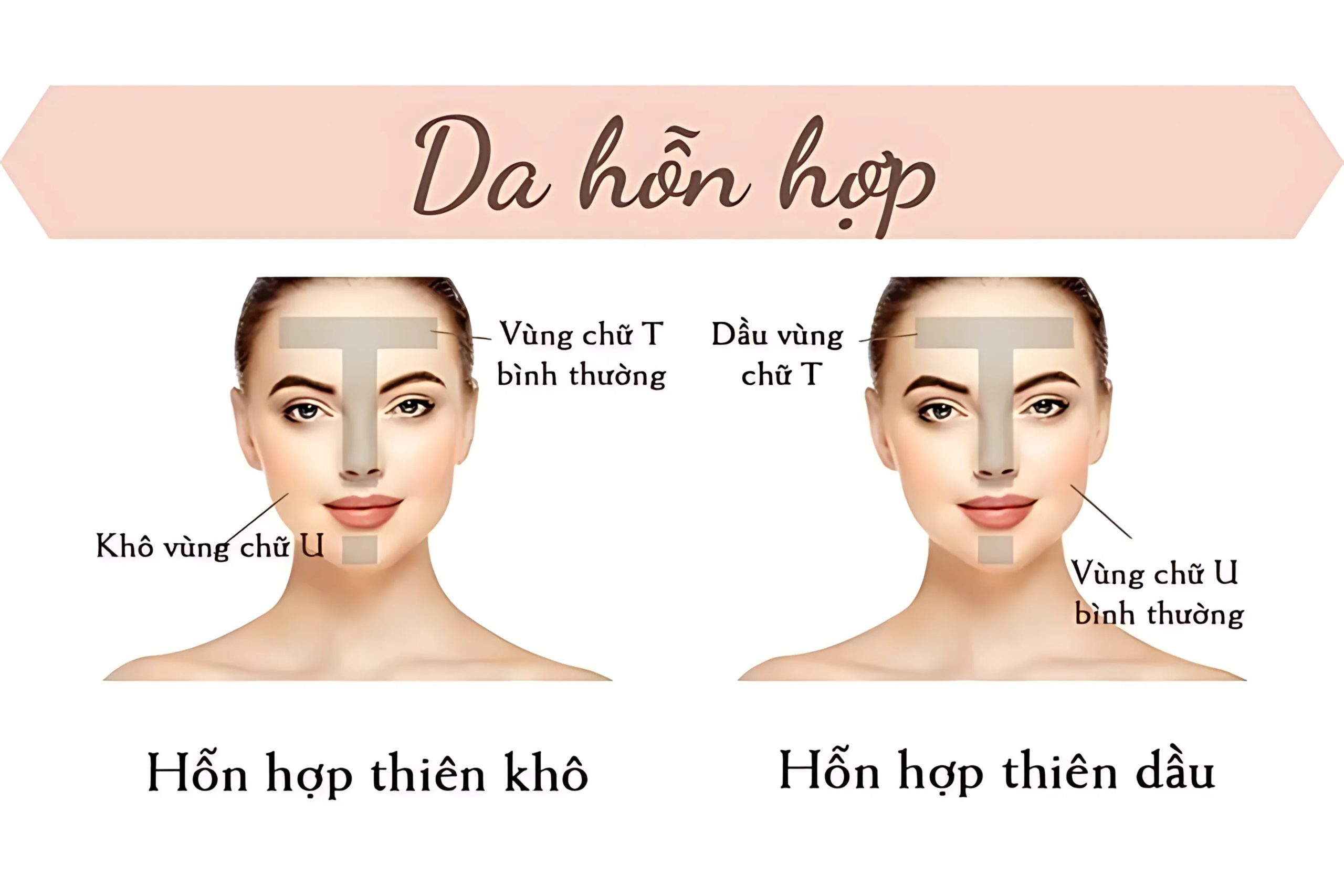 Phân biệt da hỗn hợp thiên khô và da hỗn hợp thiên dầu