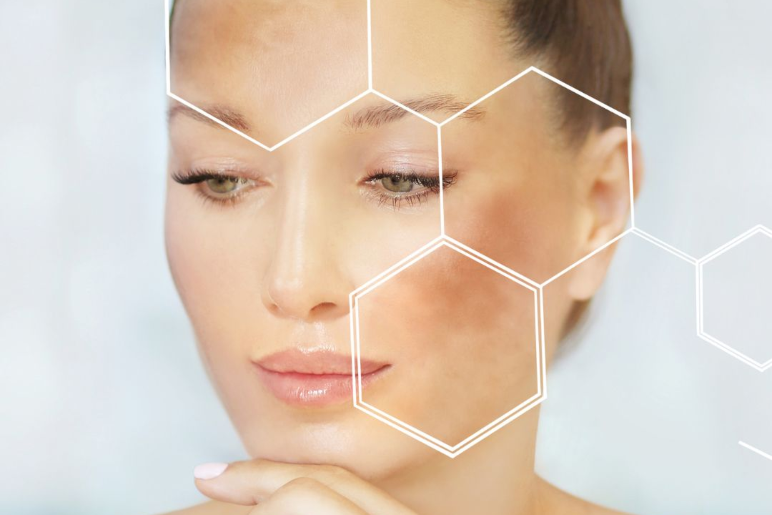 Nguyên nhân gây nám da: nội tiết tố, tia UV, mỹ phẩm kém chất lượng…